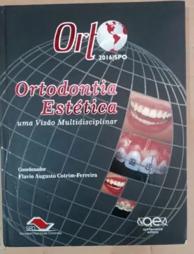 Ortodontia Estética: Uma Visão Multidisciplinar