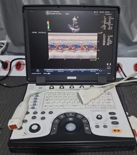 Ultrassom portátil vivid i
