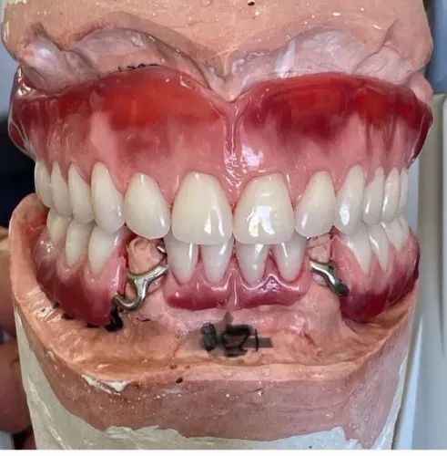 Dentadura no Conforto da Sua Casa!