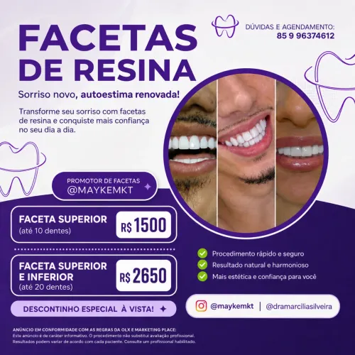 FACETAS EM RESINA