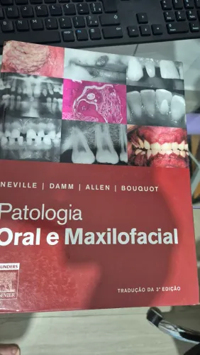 Patologia Oral e Maxilofacial Neville 3° edição