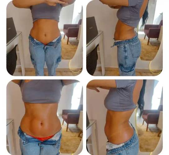 Lipo Sem Corte