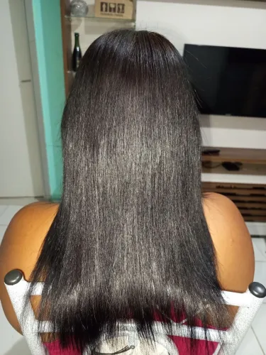 Progressiva Selagem Botox 