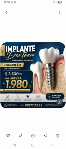Implante dentário