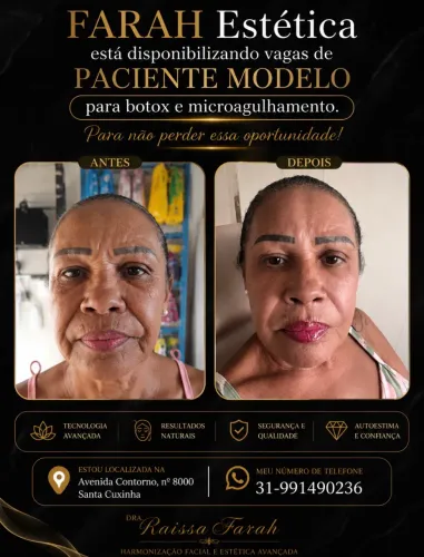 Paciente modelo 