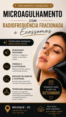 Tratamento da pele. Microagulhamento com radio fracionada e exossomas