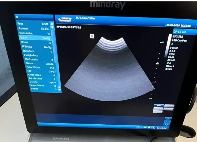Ultrassom