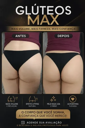 Promoção