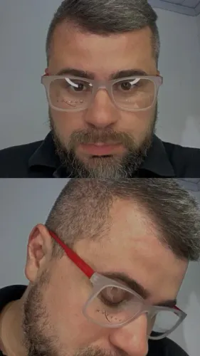 Armação Masculina