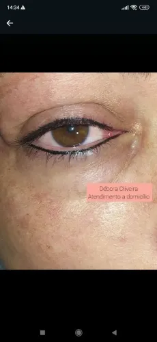 Micropigmentação dos Olhos 