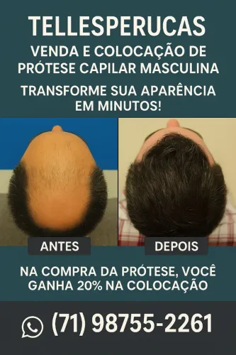 Prótese Capilar Masculina - Tellesperucas