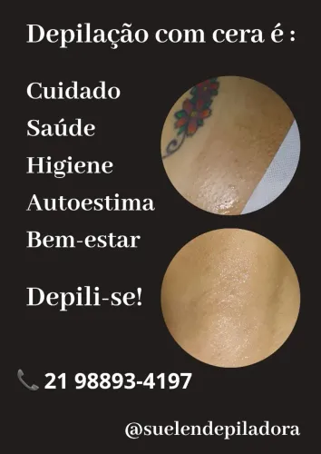 Depilação Feminina - Trindade SG