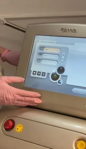 CO2 fracionado Crio laser para depilação 