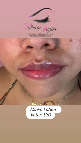 Micro Lábial 