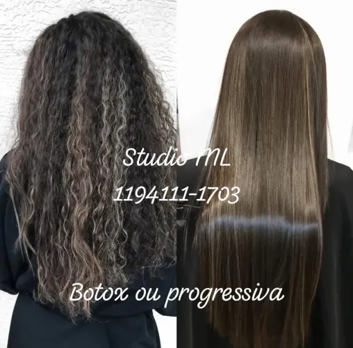 Progressiva ou botox