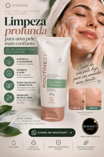 ? Gel de Limpeza Acne Control 150g | Um Passo Essencial Para Deixar Sua Rotina