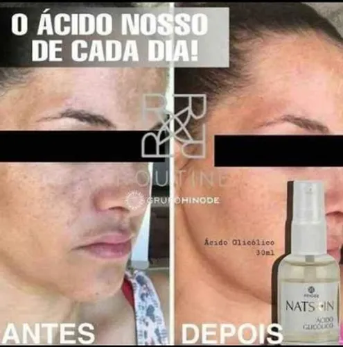 Acido Glicolico Hinode 
