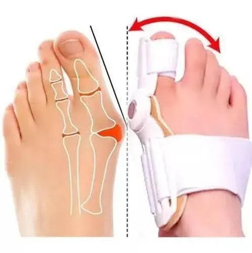 Correto de joanete ortopédica, frete grátis e pagamento na hora da entrega na porta da