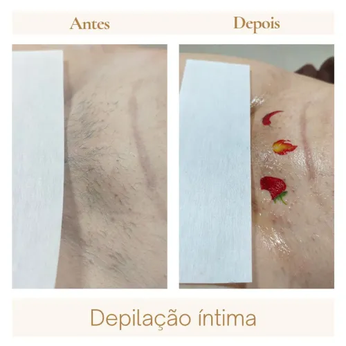 Depilação 