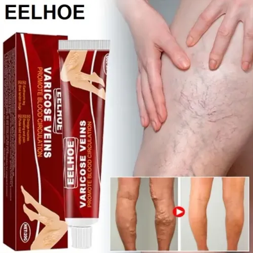 2x EELHOE Pomada Para Varizes E Circulação Sanguínea 20g Cada