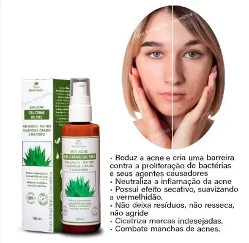 Creme Anti Acne Oil Free Flora Amazonica 100ml Promoç