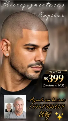 Micropigmentação capilar
