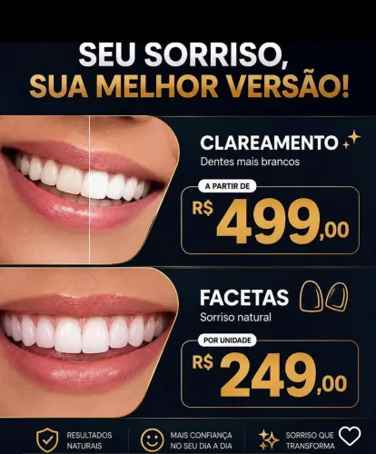 Clareamento dental ou facetas em resina 