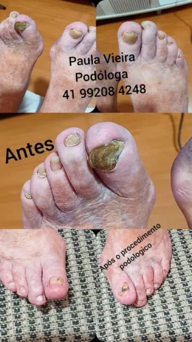 Podologia é saúde e conforto para seus pés!!