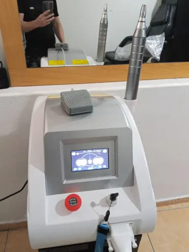 Máquina de remoção de tatuagem a lazer