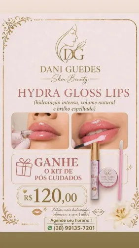 Hydra Gloss Lips