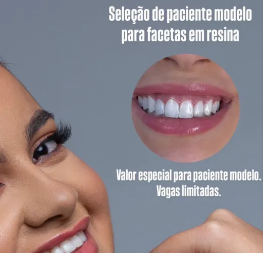 Facetas