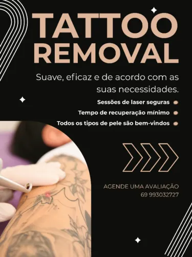 REMOVA SUA TATUAGEM