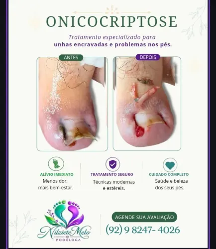 Podologia Profissional