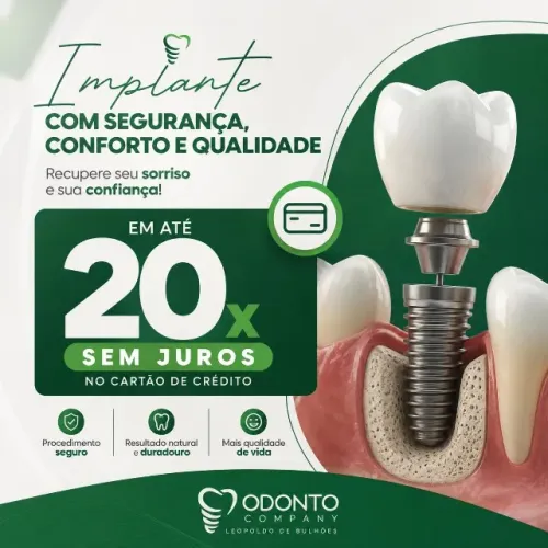 IMPLANTE DENTÁRIO