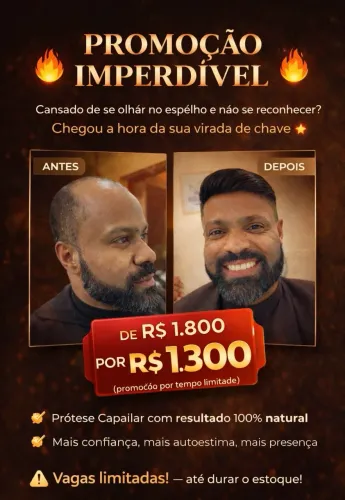 Prótese capilar 