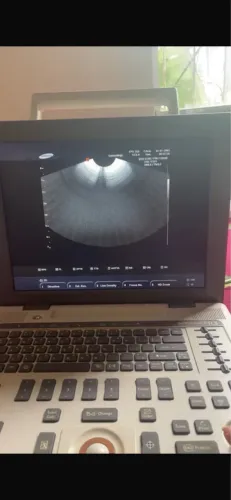 Máquina de ultrassom 