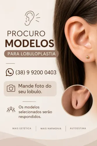 Lobuloplastia modelo