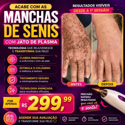 Pele sem manchas? 