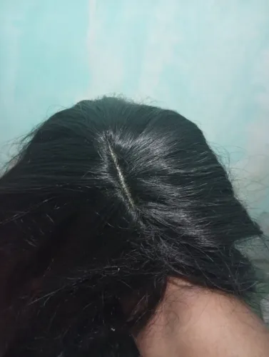 front lace 