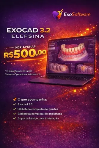 Exocad 3.2 Elefsina + biblioteca de implantes e dentes