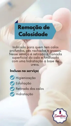 Remoção de Calosidade - Pés macios e saudáveis