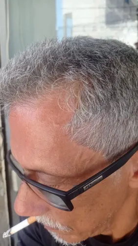 Creme pra nascer cabelo 