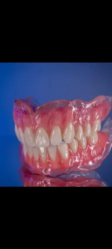 Dente Prótese Dentária 
