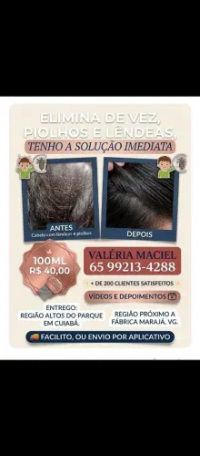 Piolhos e lêndeas nunca mais