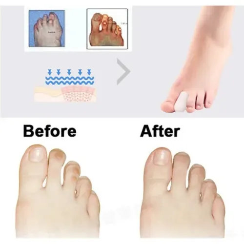 Par Protetor Dedos Silicone Maleável Macio wpp:43.99611-398