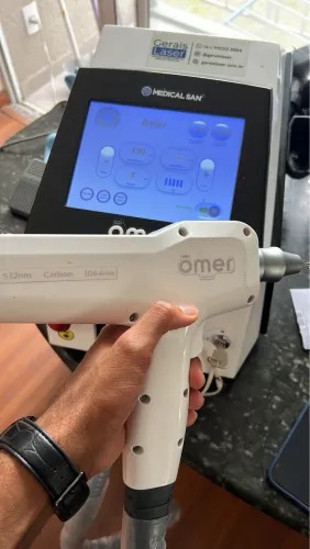 Laser Omer Smart - Remoção de tatuagem e sobrancelhas