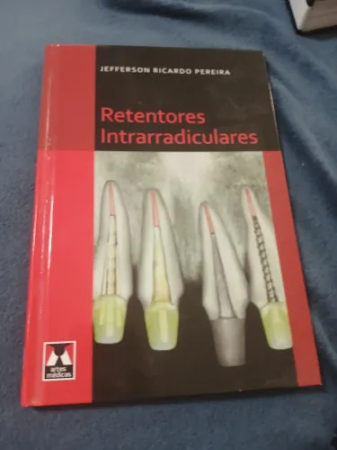 Livro de odontologia " Retentores Intrarradiculares "