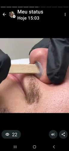 *Depilação cera ,máquina 