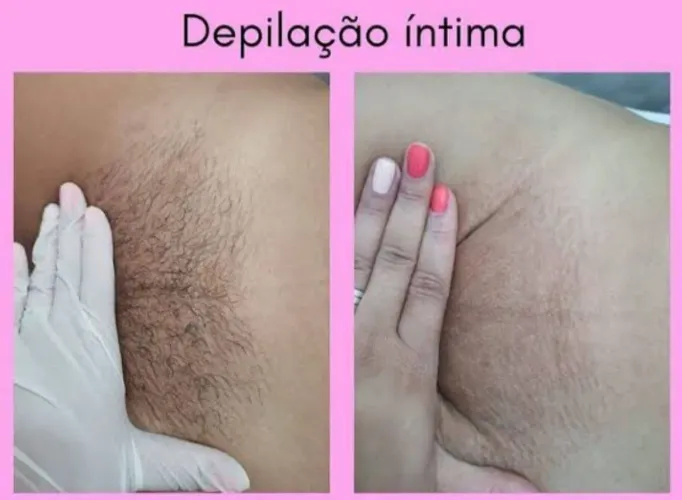 Depilação na cera