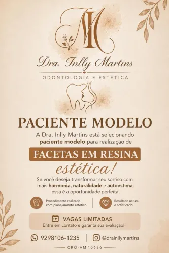 Facetas em Resina (paciente modelo)